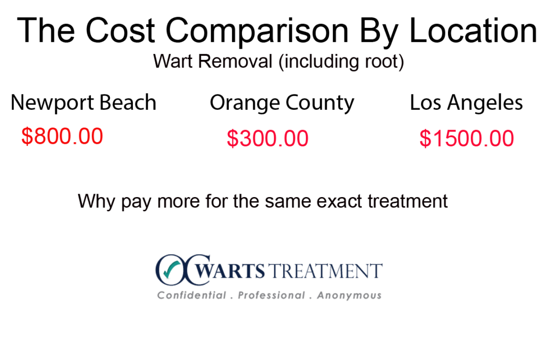 Warts treatment pricing: $800, $300, $1500